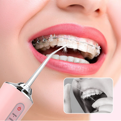 Irrigador Bucal Portátil Limpieza Dental