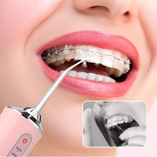Irrigador Bucal Portátil Limpieza Dental